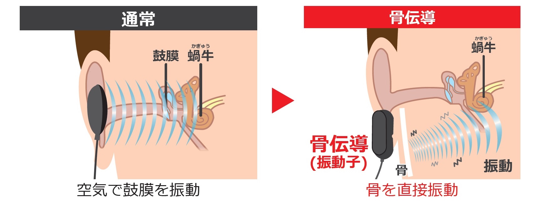 デバイスの特性を生かす独創のハウジング技術