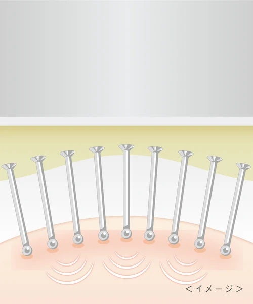 �\�t�g�N�b�V�����ƃ��^���̋��悪������₳�����h��