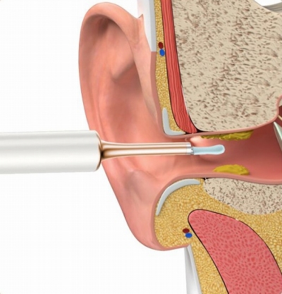 6���X�}�[�g�W���C���X�R�[�v����