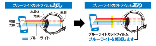 �ᐸ��J�̗v���̈�̃u���[���C�g���J�b�g