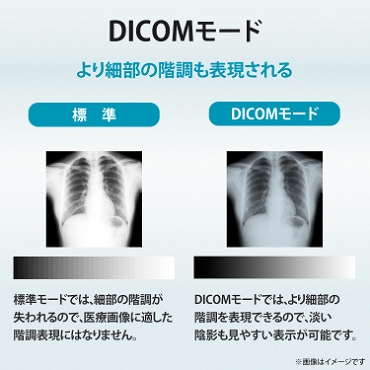 DICOM���[�h