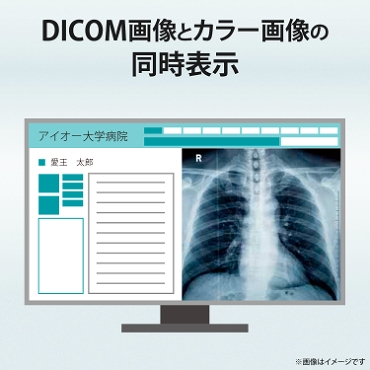 DICOM�摜�ƃJ���[�摜�̓����\��