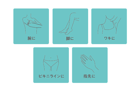 ���L���ӏ��ɑΉ��őS�g�P�A