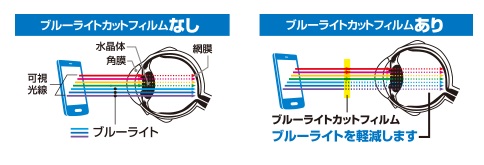 �ᐸ��J�̗v���̈�̃u���[���C�g���J�b�g