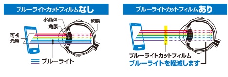 �ᐸ��J�̗v���̈�̃u���[���C�g���J�b�g