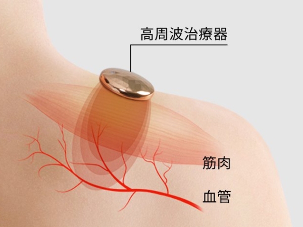 �����g�́A���ǂɍ�p�B���h���B