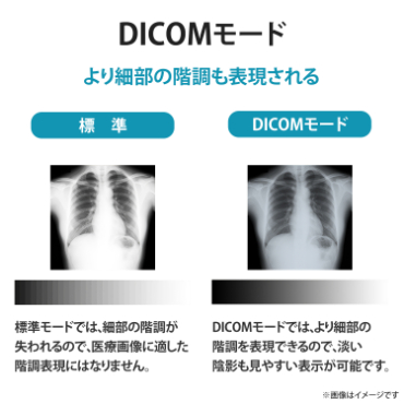 DICOM���[�h