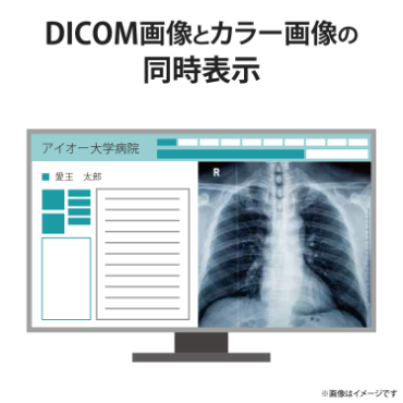 DICOM�摜�ƃJ���[�摜�̓����\��