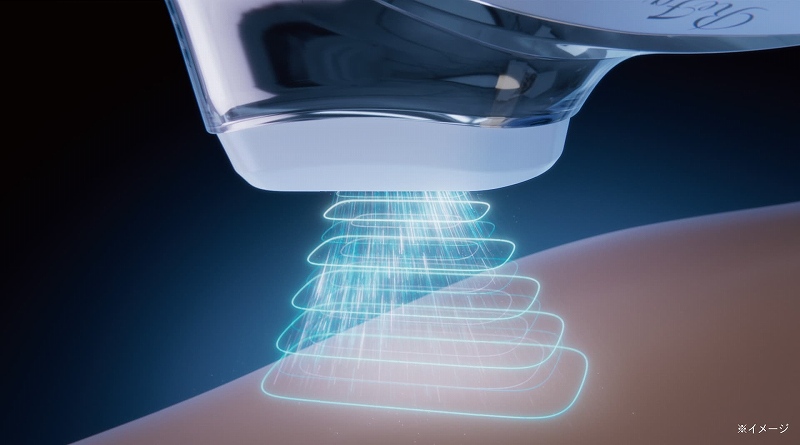 �ō��o��30J��2�̃p���t�����Ǝ�