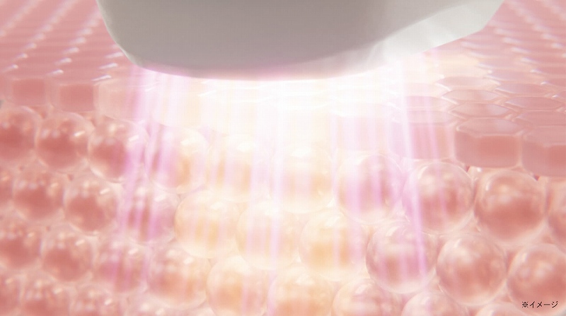 ����ɂ��Ȃ���A���e�{�p���z�̌��P�A