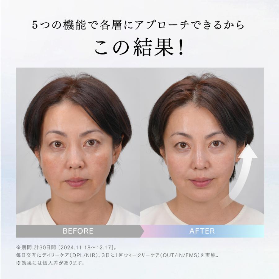 5�̋@�\�Ŋe�w�ɃA�v���[�`�ł��邩�炱�̌���