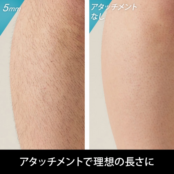 �A�^�b�`�����g�ŗ��z�̒�����