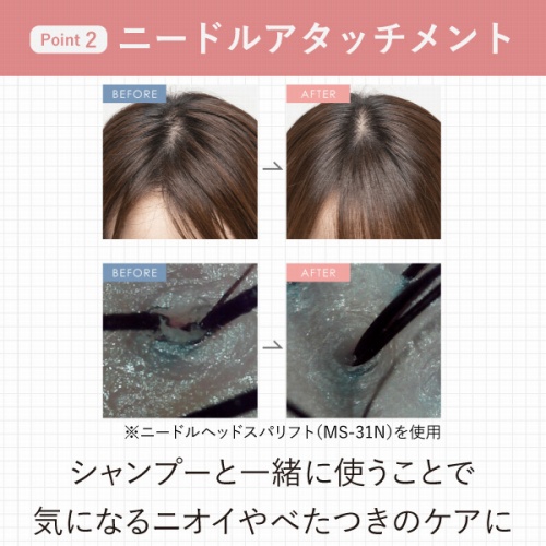 �j�[�h���A�^�b�`�����g