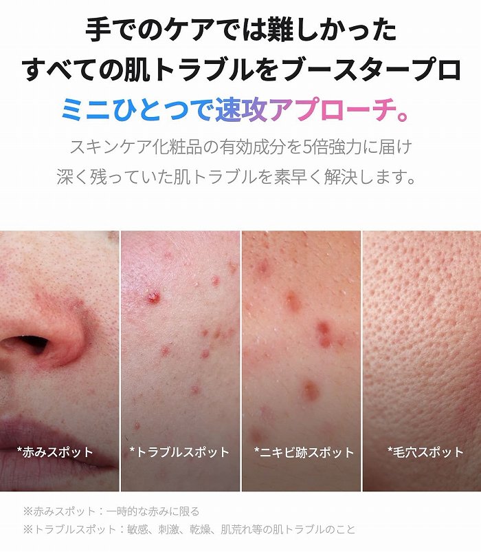 ��ł̃P�A�ł͓�������S�Ĕ��g���u�����u�[�X�^�[�v���~�j�ő��U�A�v���[�`