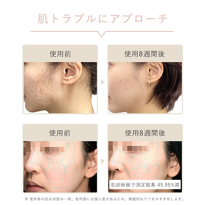 ���g���u���ɃA�v���[�`