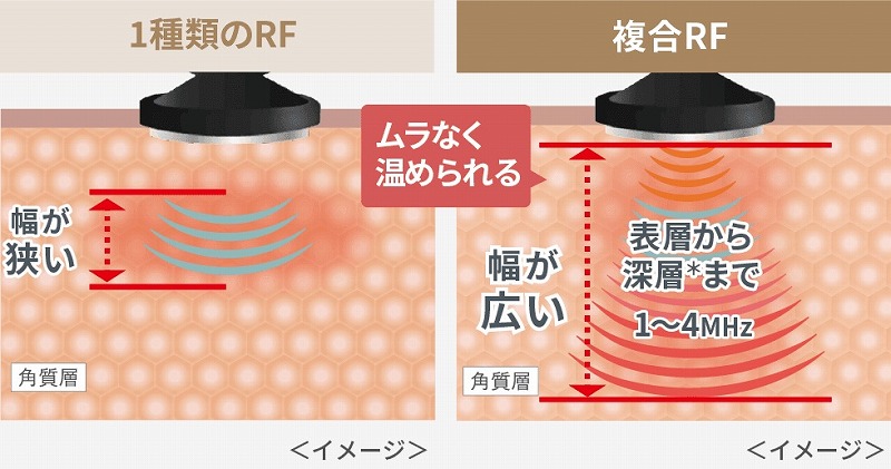 ���[�}�� �t�H�g�v���X �f�B�[�v���t�g ����F�z���C�g YJFA1W RF�Łu�w�v�ɃA�v���[�`