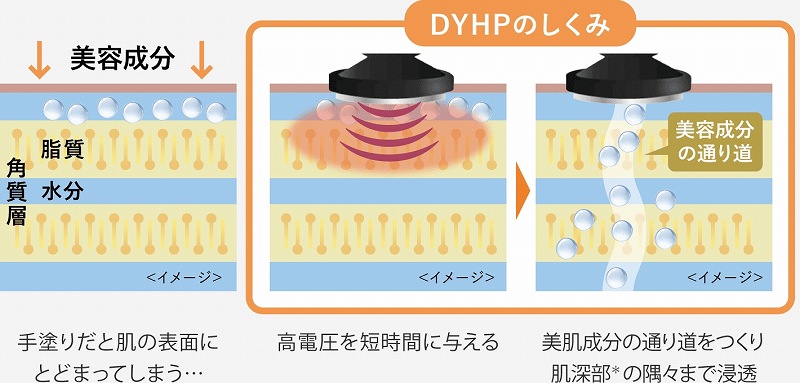 ���[�}�� �t�H�g�v���X �f�B�[�v���t�g ����F�z���C�g YJFA1W DYHP(�_�C�i�~�b�N�n�C�p�[�p���X)�̎d�g�݂ɂ���
