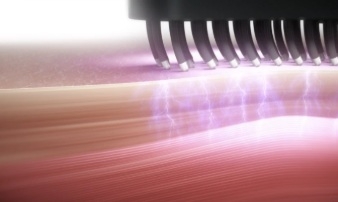 �f���A�����[�hEMS