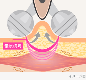 3354290_���烍�[���[2