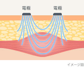 3354290_���烍�[���[3