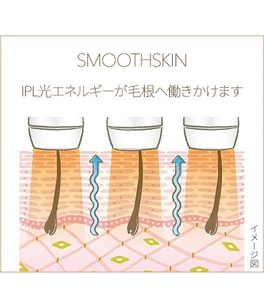 3622878_���G�X�e3