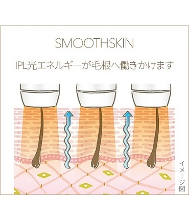 3622879_���G�X�e3