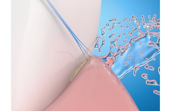 �ɍזтŗD����������0.01mm �̋ɍזт��̗p