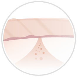 ����� �u�g���A �X�L�� �G�C�W���O�P�A���[�U�[�v�@SRL-L ���C���b�N �C���[�W�F�����̕ω�