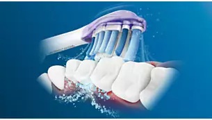 �t�B���b�v�X �\�j�b�P�A�[�̍Ő�[�̉��g����