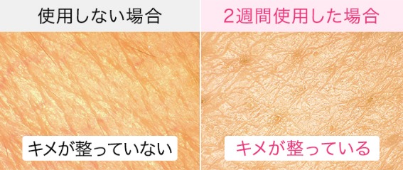 5752257_�t�F�C�X�X�`�[�}�[2