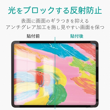 �����̔��ˁE�f�荞�݂�}����