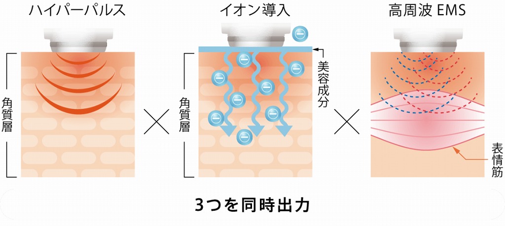 �n�C�p�[�p���X&times;EMS&times;�C�I�������𓯎��ɏo��