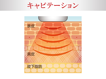 �L���r�e�[�V����