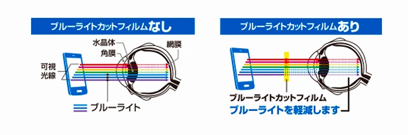 �G���R���t�B����