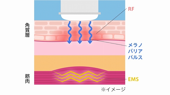 �q�e����� ���[�}���@�FLED�@RF�@�C�I�����o�@EMS �����m�o���A�p���X�@��p�@