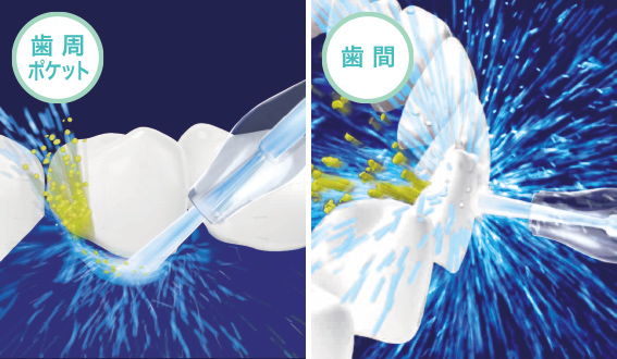 �r���[�e�B�[�E���N�Ɠd �I�[�����P�A ���o��� ���o���� �p�i�\�j�b�N�@Panasonic  ���o����mAC100-240V�n �W�F�b�g�E�H�b�V���[�h���c EW-CDJ74-W�@�r�b�N�J����