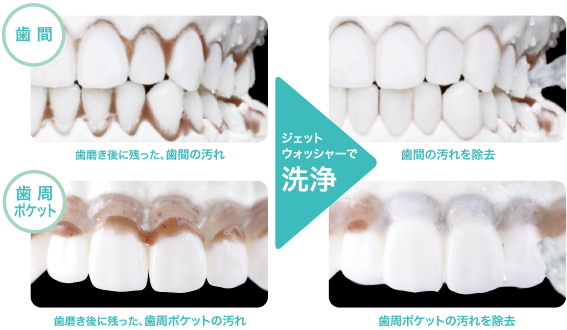 �r���[�e�B�[�E���N�Ɠd �I�[�����P�A ���o��� ���o���� �p�i�\�j�b�N�@Panasonic  ���o����mAC100-240V�n �W�F�b�g�E�H�b�V���[�h���c �� EW-CDJ54-W �r�b�N�J����