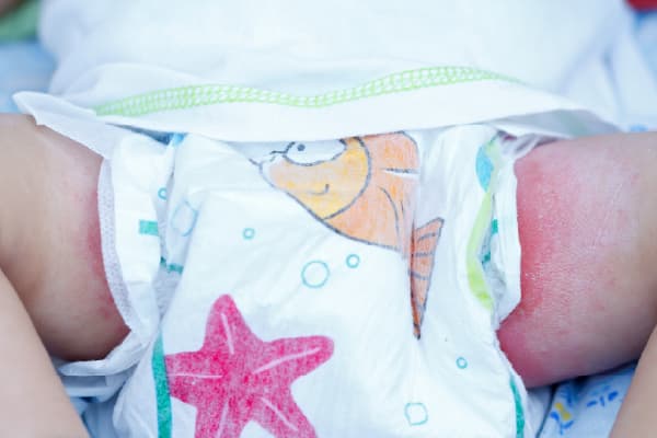 �V�����̂��ނI�тő����Y�݂Ǝ��s�� �悭���鎸�s�p�^�[�� ���ނ��Ԃꂪ�N���Ă��܂���