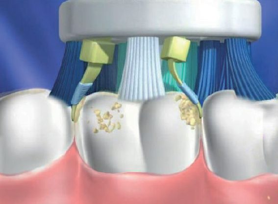 ���W_�d�����u���V2